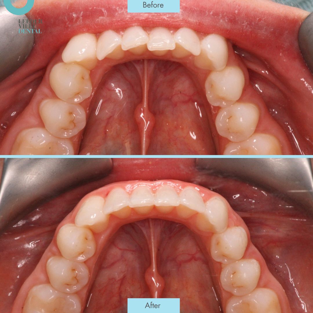 sile true Leederville Dental Post (1)