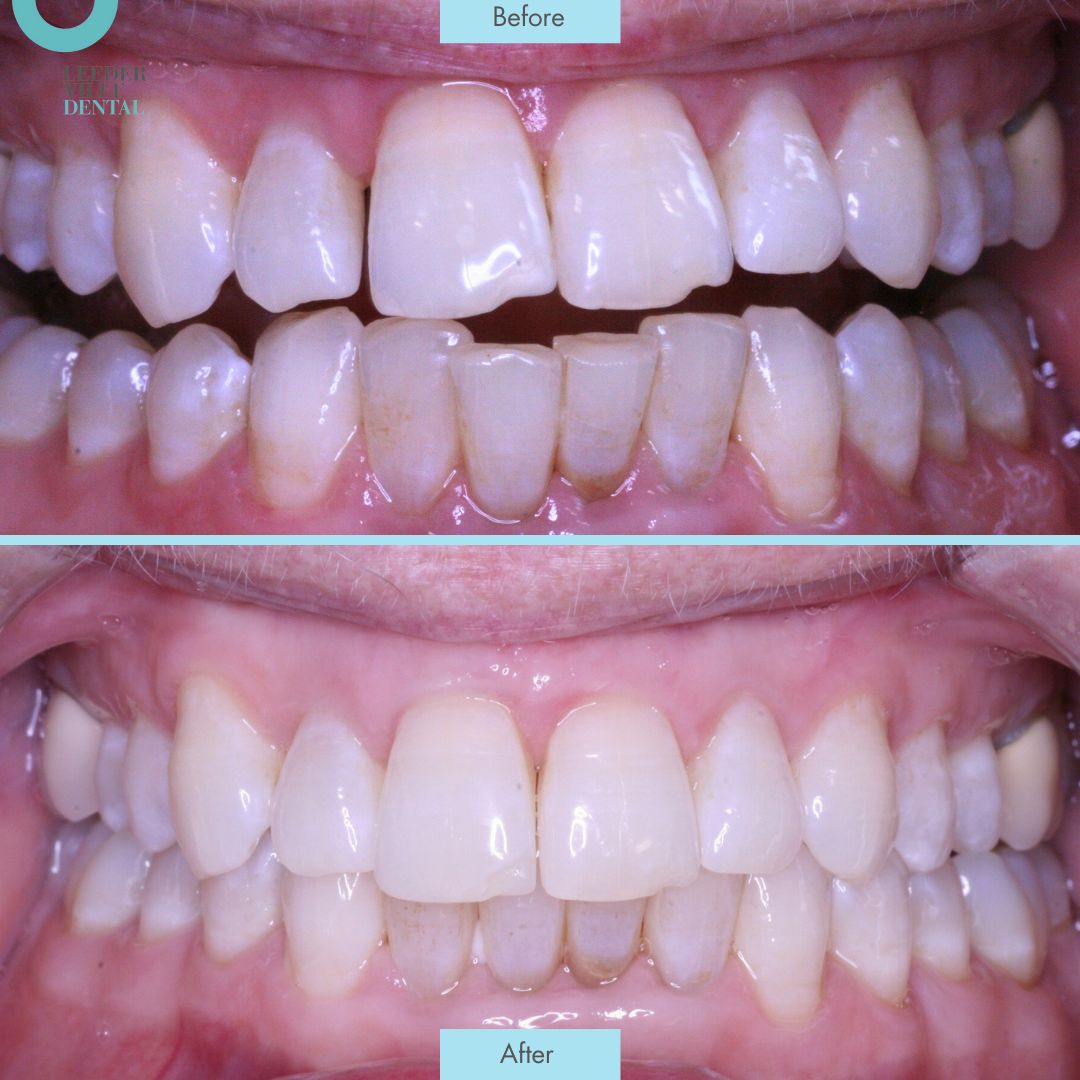 sile true Leederville Dental Post (2)