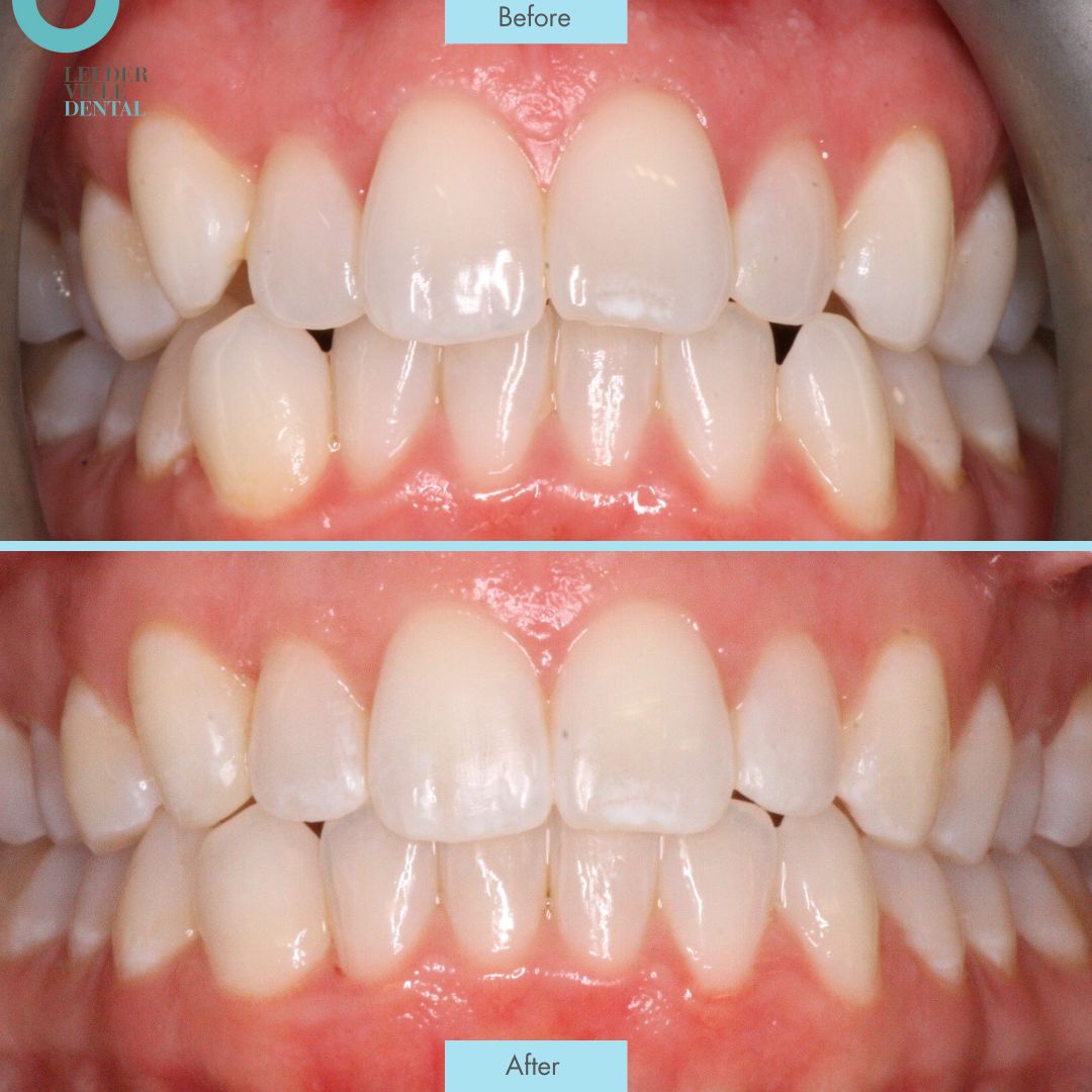 sile true Leederville Dental Post