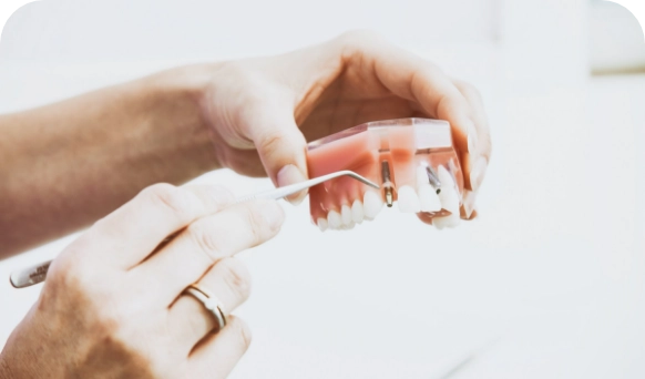 Dental Implants Leederville