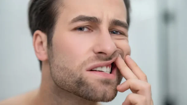 mottling of teeth