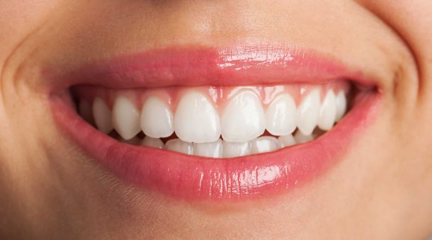 How Long Does Teeth Whitening Last