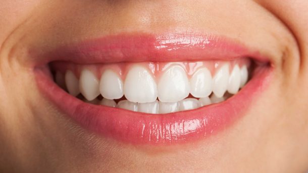 How Long Does Teeth Whitening Last