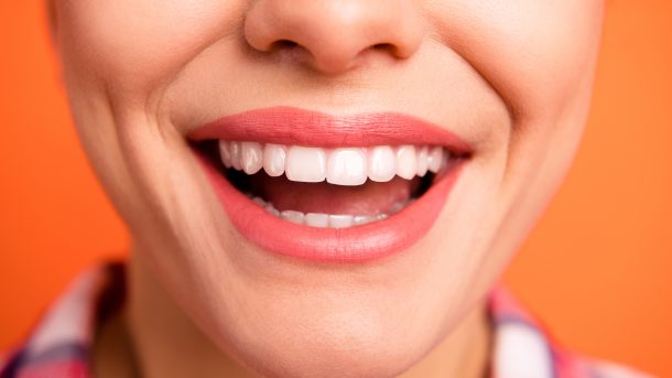 teeth whitening dental care